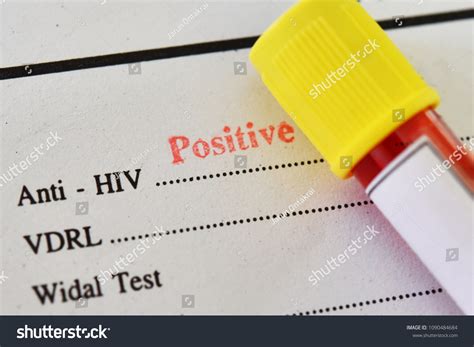 hiv positive results images|16,242 Hiv Positive Images, Stock Photos & Vectors .